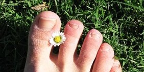 Грибок нігтів на ногах
