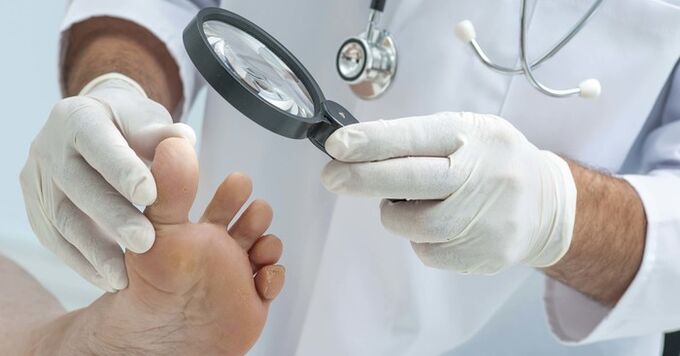 Діагностичний огляд нігтів на нозі