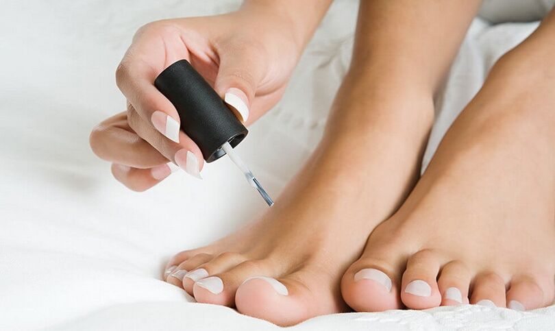 нанесення лаку для лікування грибка на нігтях ніг